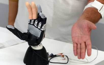Российские биоинженеры создали нейроинтерфейс для протезов нового поколения